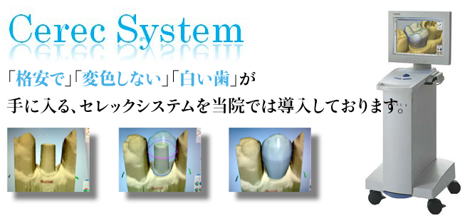 「1日」で「格安で」「変色しない」「白い歯」が  手に入る、セレックシステムを当院では導入しております。