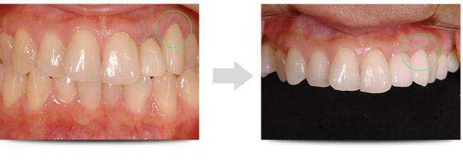 before_After-1